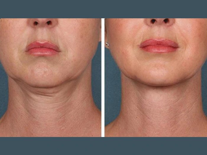 Best Doctors in Dubai for PRP Treatment and Celebrity Skin Secrets