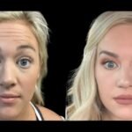 How the Best Aesthetic Clinic in Dubai Ensures Safe and Natural Results