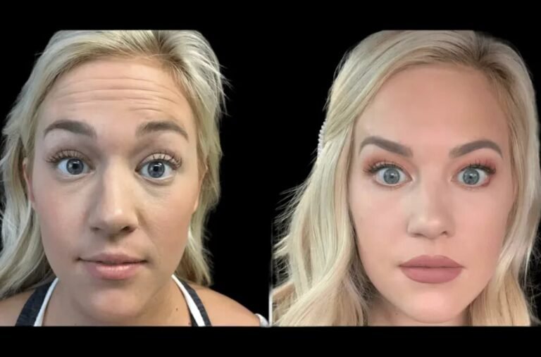 How the Best Aesthetic Clinic in Dubai Ensures Safe and Natural Results