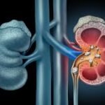 Best Urology Surgeon in Jaipur – Advanced Treatment & Trusted Surgical Expertise