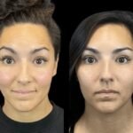 Top Treatments You Can Expect From the Best Aesthetic Clinic in Dubai