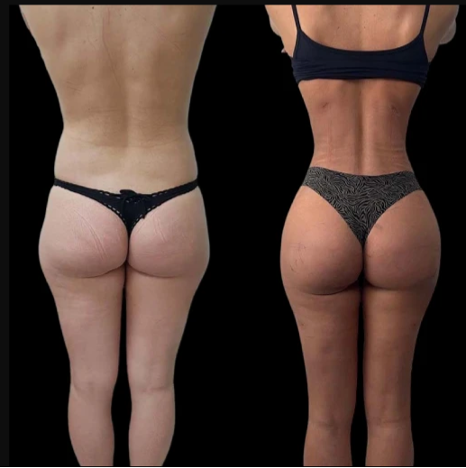 From Sagging to Snatched: J-Plasma Magic by the Best Doctors in Dubai