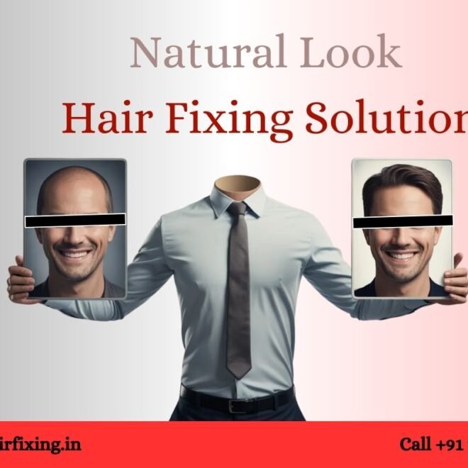 Top Benefits of Hair Replacement in 2026
