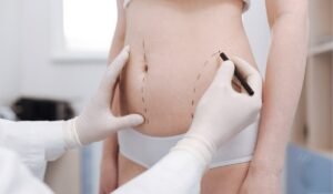 How to Pick the Best Liposuction Surgeons in Dubai for Your Needs