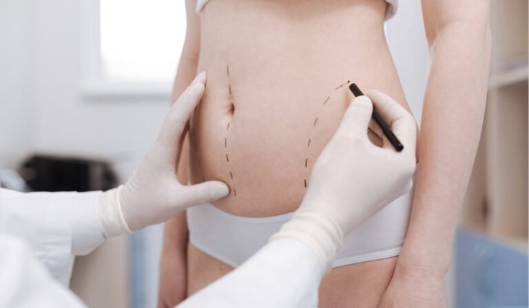 How to Pick the Best Liposuction Surgeons in Dubai for Your Needs