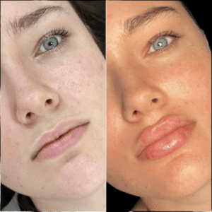 Best Plastic Surgeon in Dubai for Fillers for Enhanced Facial Beauty