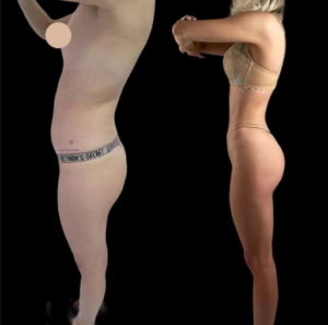 How the Best Plastic Surgeon in Dubai Enhances Skin with J-Plasma