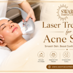 Swarna Cosmetics Expert Laser Treatments For Acne Scars And Pigmentation
