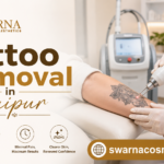 Laser Tattoo Removal: Complete Guide To Safe And Effective Tattoo Removal