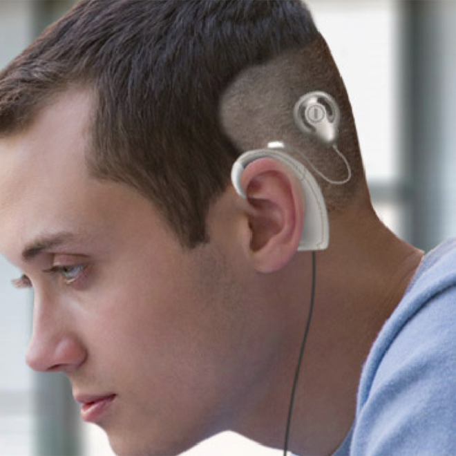 Cochlear Implant Price in Pakistan – Cost, Factors & Complete Guide (2026)