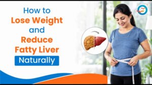 How to Lose Weight and Reduce Fatty Liver Naturally