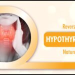 How to Reverse Hypothyroidism Naturally?