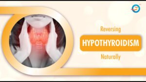 How to Reverse Hypothyroidism Naturally?