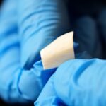 Advancing Wound Recovery Through Amniotic Membrane Products and Medical Technology