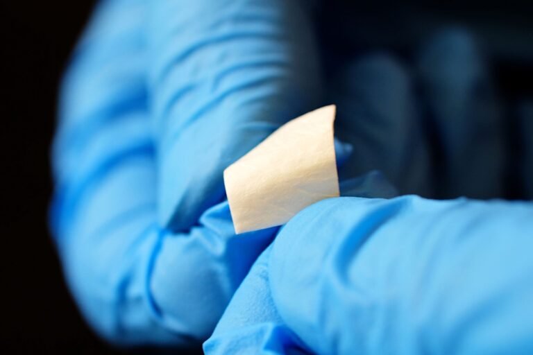 Advancing Wound Recovery Through Amniotic Membrane Products and Medical Technology