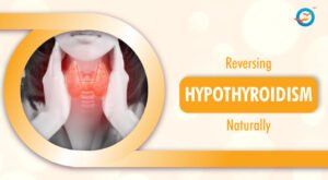 How to Reverse Hypothyroidism Naturally?