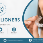 Teeth Aligners for a Discreet Smile Transformation