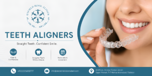 Teeth Aligners for a Discreet Smile Transformation